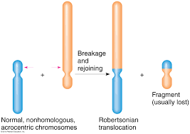 Robertsonian Translocation