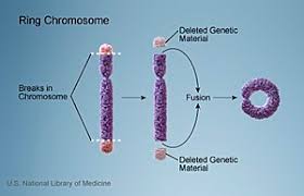 Ring chromosome - Wikipedia