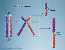 Isochromosome - Wikipedia