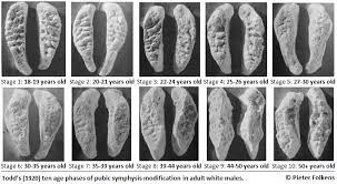 Quick Tips: How To Estimate The Chronological Age Of A Human Skeleton – Pubic Symphyseal Surface Method. | All Things AAFS!