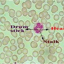 Neutrophil: Drumstick with head connected by a narrow filamentous stalk. | Download Scientific Diagram